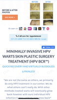 Best warts treatment