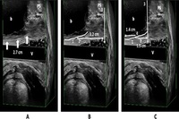 BTL EMSELLA™ For Women - raymondduongmd.com