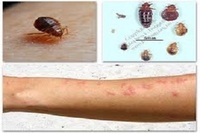 Bed Bug Treatment in Richmond VA