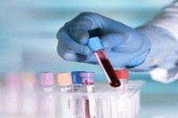 Blood Test London - Home