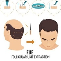 capitalhairrestoration
