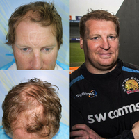capitalhairrestoration