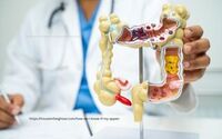 Appendix, Head Knots, Vitamin D, and Kidney Stones: Key Symptoms to Watch